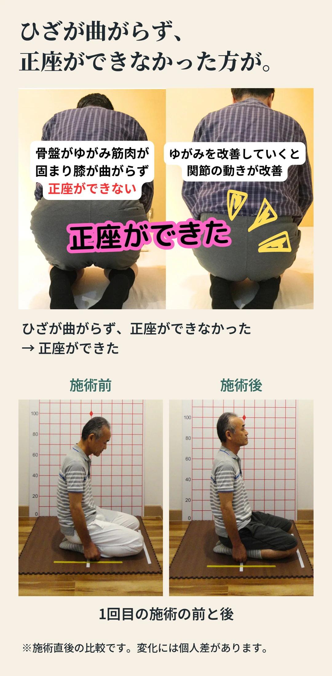 ひざが曲がらず、 正座ができなかった方が。 骨盤がゆがみ筋肉が固まり膝が曲がらず正座ができない ゆがみを改善していくと関節の動きが改善 正座ができた ひざが曲がらず、正座ができなかった → 正座ができた 施術前 施術後 1回目の施術の前と後 ※施術直後の比較です。変化には個人差があります。