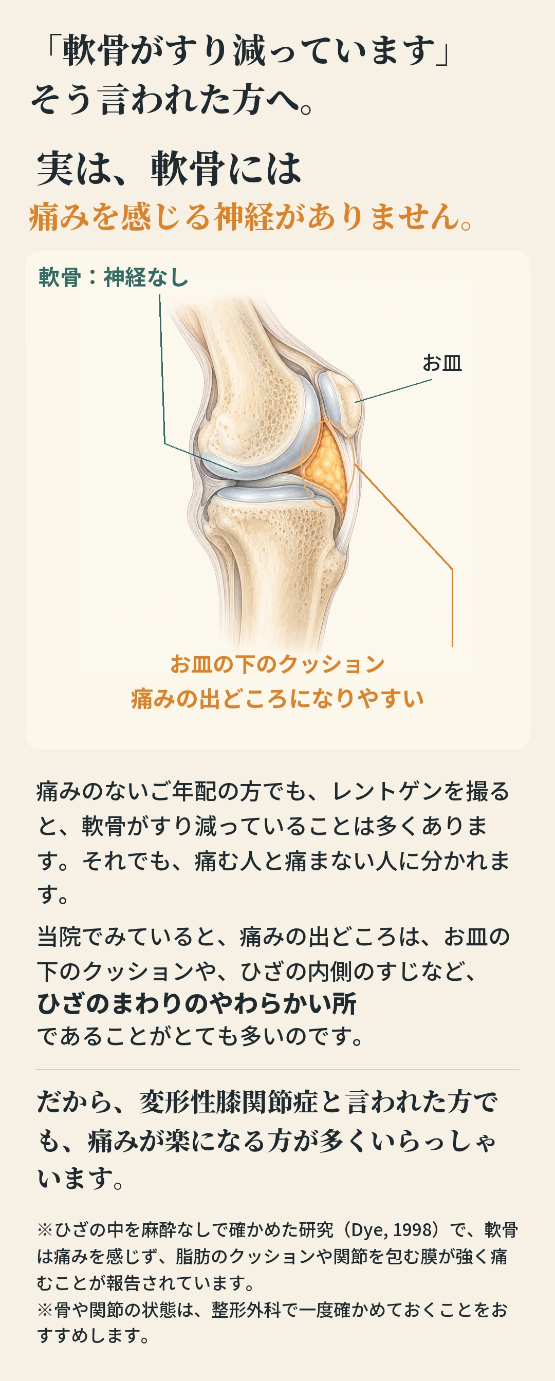 「軟骨がすり減っています」 そう言われた方へ。 実は、軟骨には 痛みを感じる神経がありません。 軟骨：神経なし お皿 お皿の下のクッション 痛みの出どころになりやすい 痛みのないご年配の方でも、レントゲンを撮る と、軟骨がすり減っていることは多くありま す。それでも、痛む人と痛まない人に分かれま す。 当院でみていると、痛みの出どころは、お皿の 下のクッションや、ひざの内側のすじなど、 ひざのまわりのやわらかい所 であることがとても多いのです。 だから、変形性膝関節症と言われた方で も、痛みが楽になる方が多くいらっしゃ います。 ※ひざの中を麻酔なしで確かめた研究（Dye, 1998）で、軟骨 は痛みを感じず、脂肪のクッションや関節を包む膜が強く痛 むことが報告されています。 ※骨や関節の状態は、整形外科で一度確かめておくことをお すすめします。